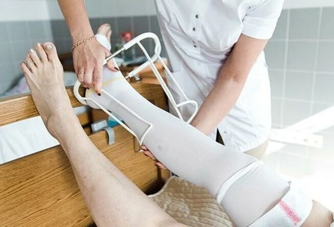 Bacakların damarlarında ameliyattan postoperatif dönem